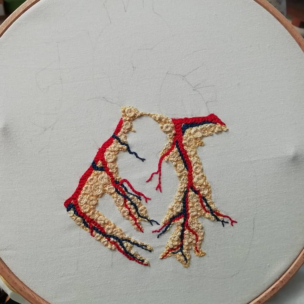 Faint pencil outline on white fabric (partially embroidered) of an anatomical heart. The veins and arteries on the surface of the heart have been stitched in red and blue.  Around these are small rosettes of yellow thread intended to represent a layer of fat.